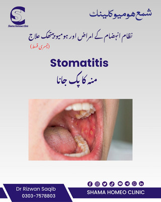 Stomatitis  منہ کی سوزش یا چھالے  