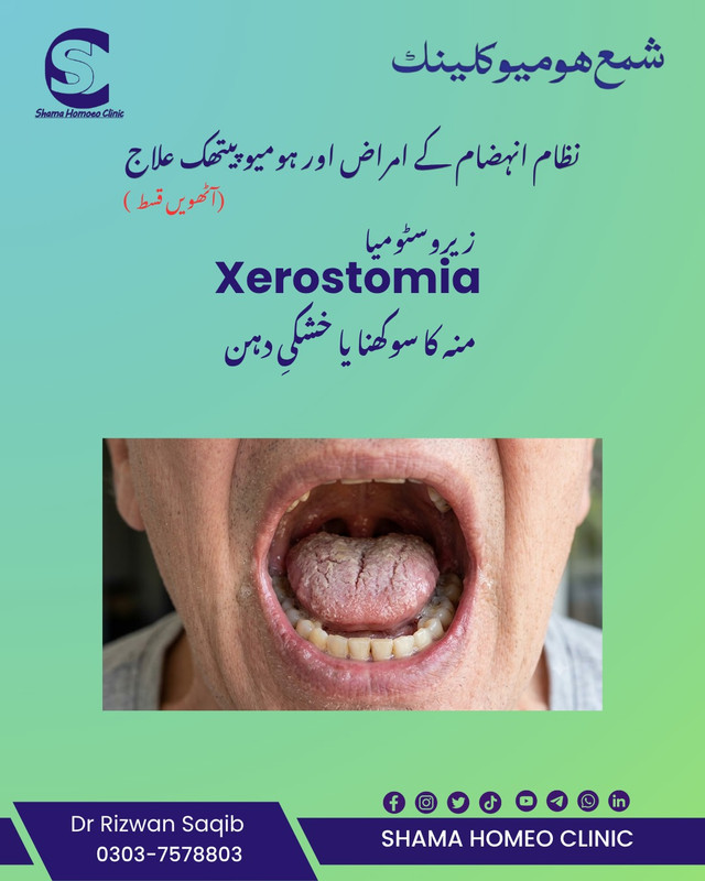 Xerostomia منہ کا سوکھنا 