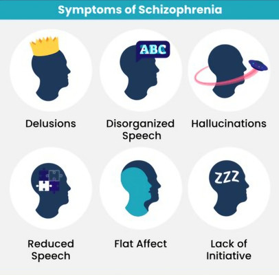 شیزوفرینیا Schizophrenia