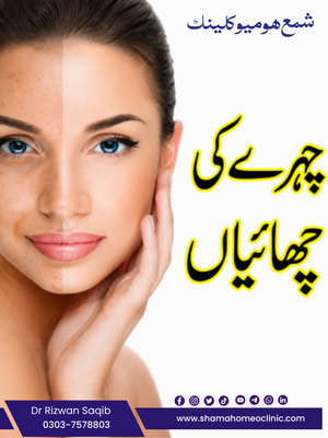 چہرے کی چھائیاں